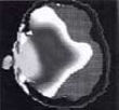 waveshield_image18